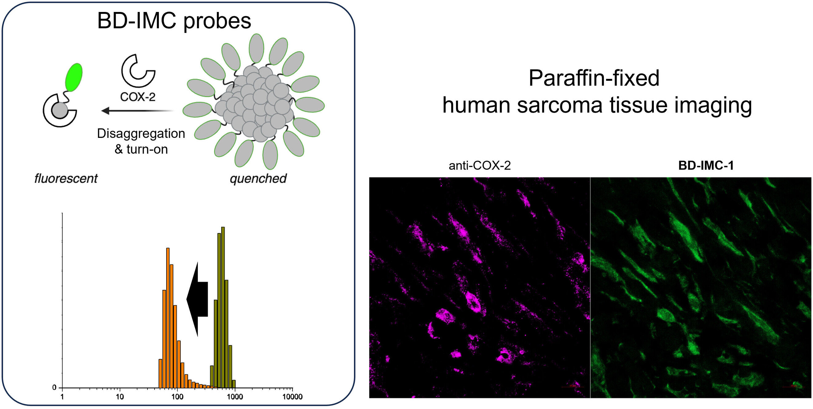 New molecular sensor enables fluorescence imaging for assessing sarcoma severity