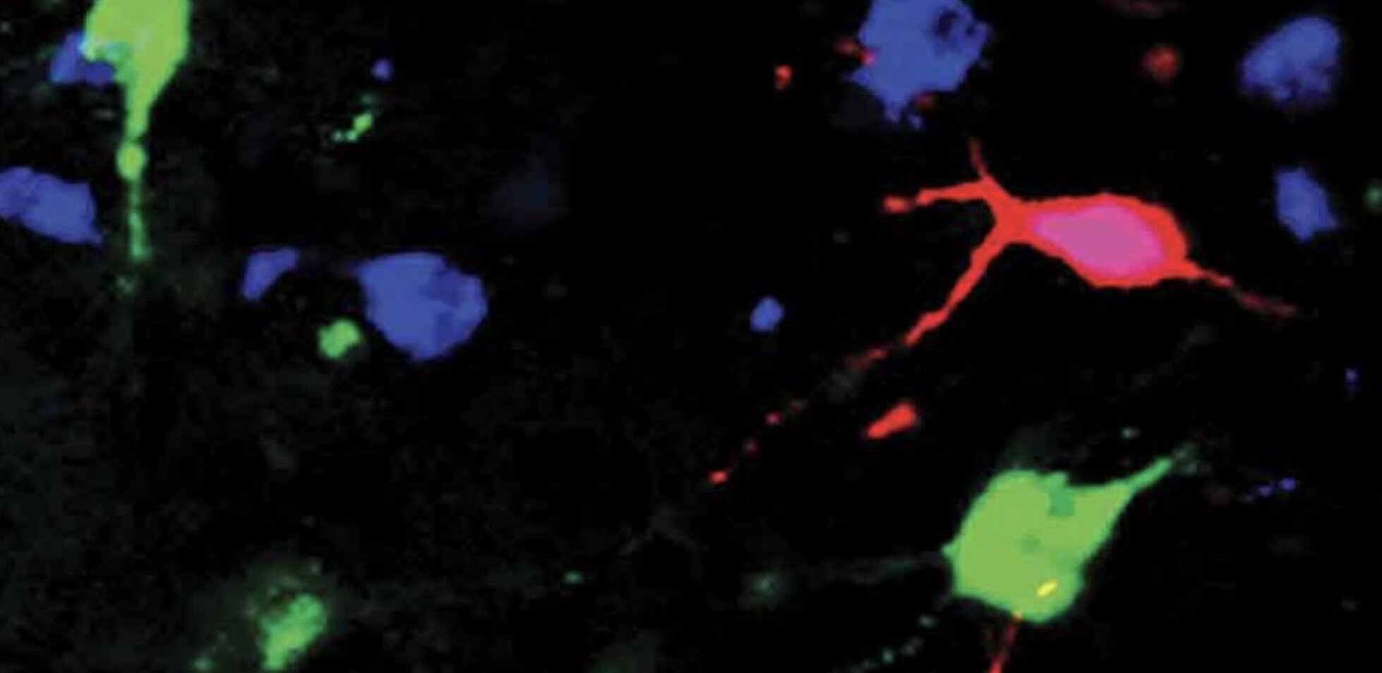 #Study shows orexin neurons can track how fast blood glucose changes