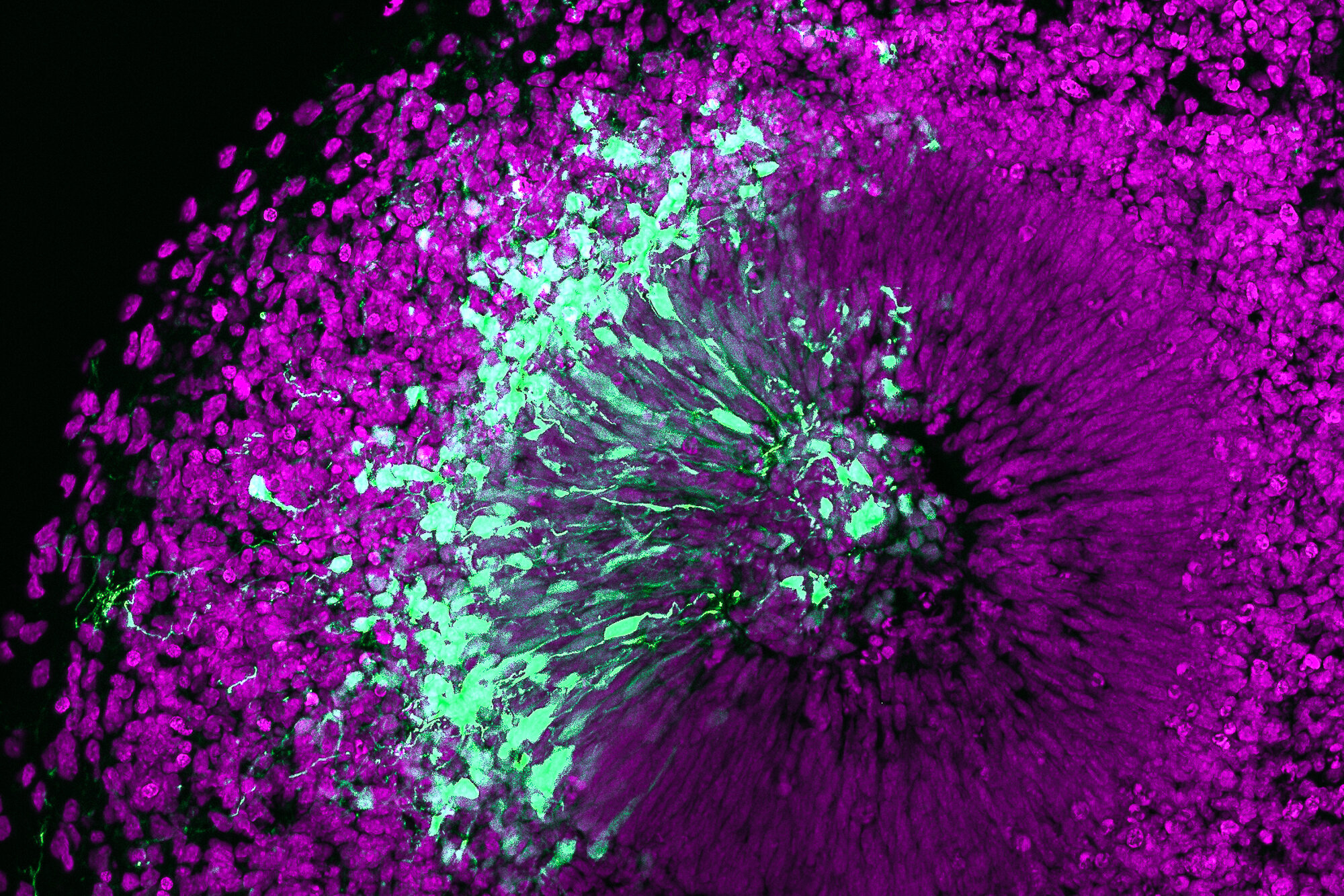 photo of Organoids research identifies factor involved in brain expansion in humans image