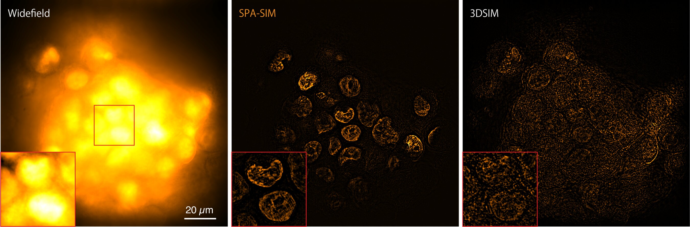 #New super-resolution microscopy approach visualizes internal cell structures and clusters via selective plane activation