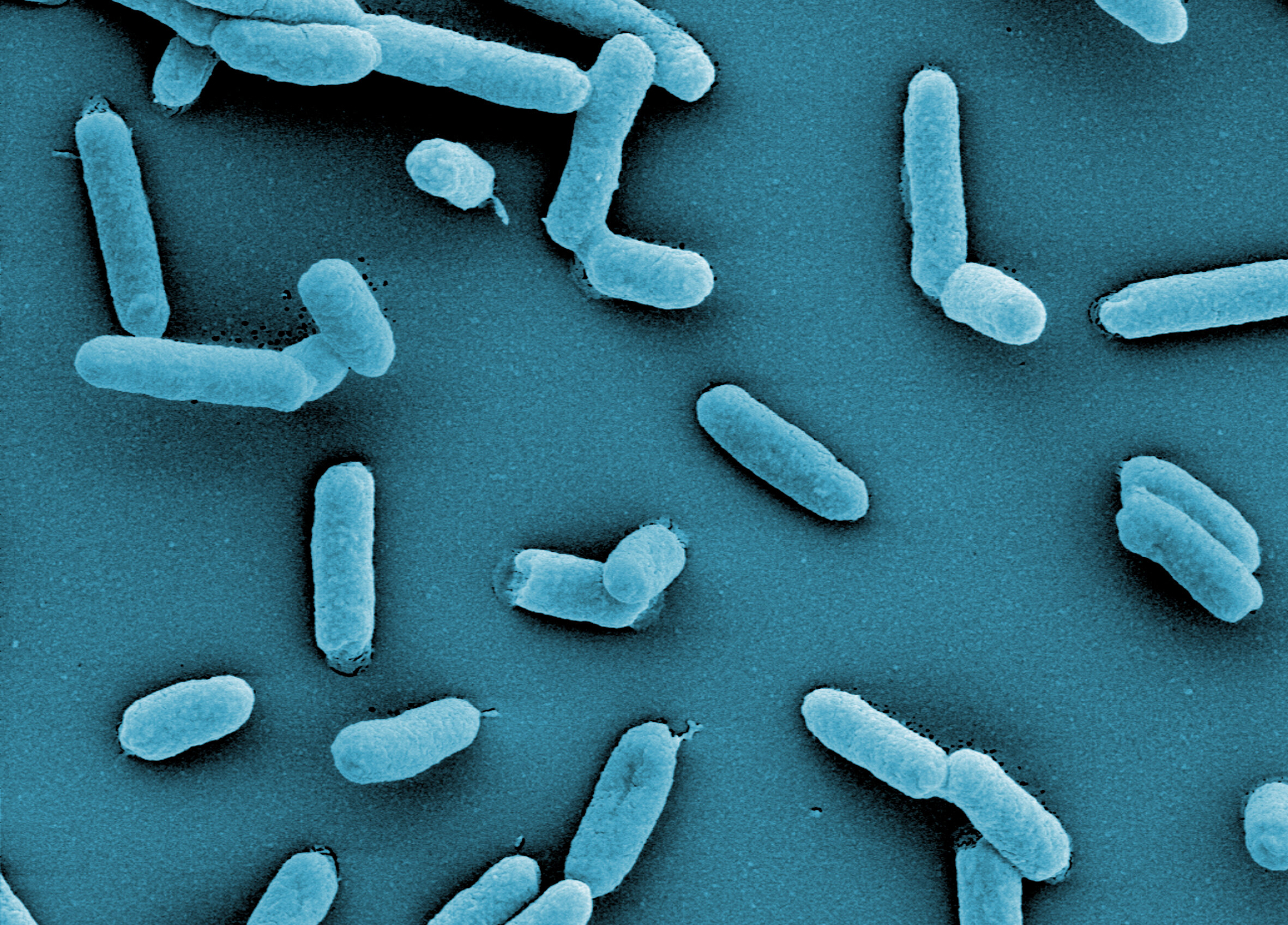 Read more about the article Exploring the world of bacteria – researchers present a new approach to make bacteria accessible for genetic engineering