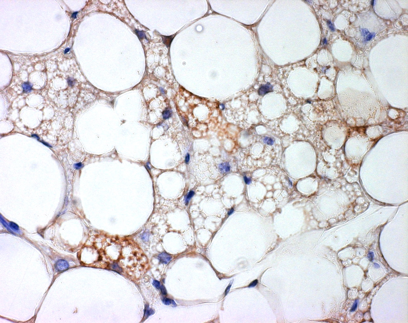 Бурая жировая ткань под микроскопом